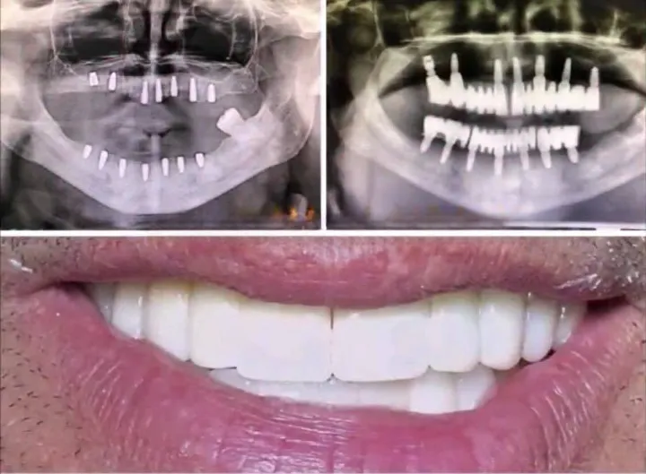 Chirurgie régénératrice