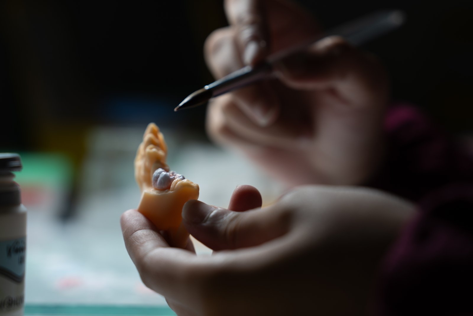 Dents provisoires immédiates